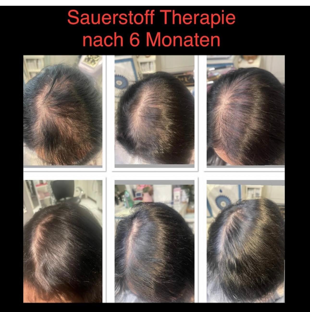 Vorher-Nachher Behandlung