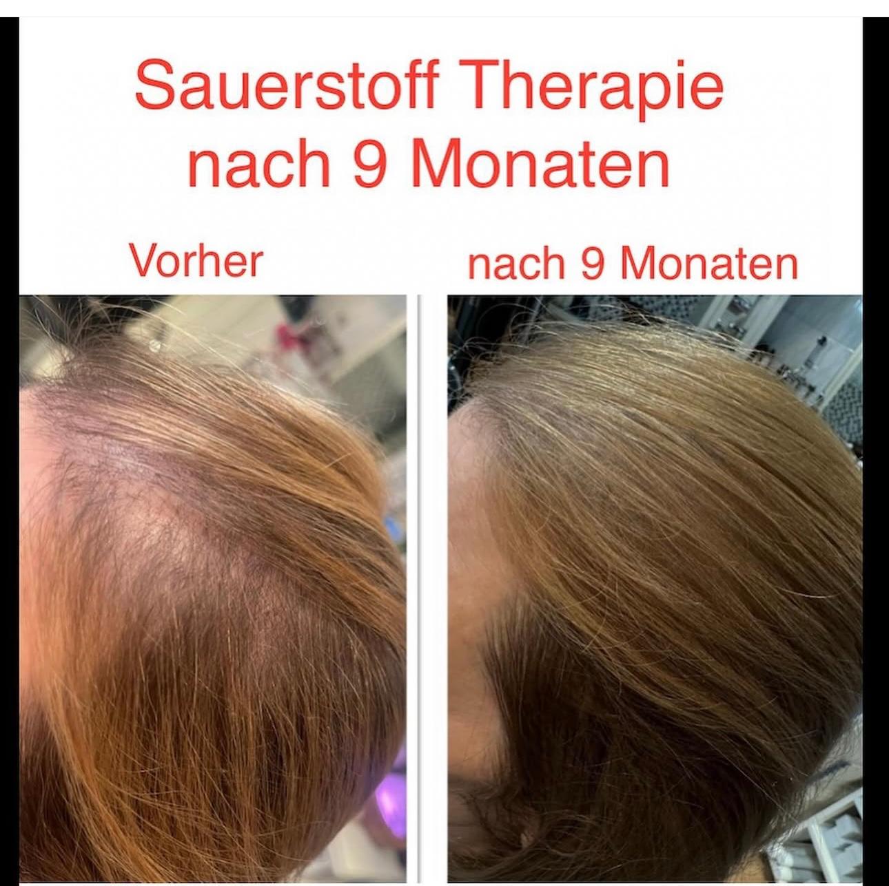 Vorher-Nachher Behandlung