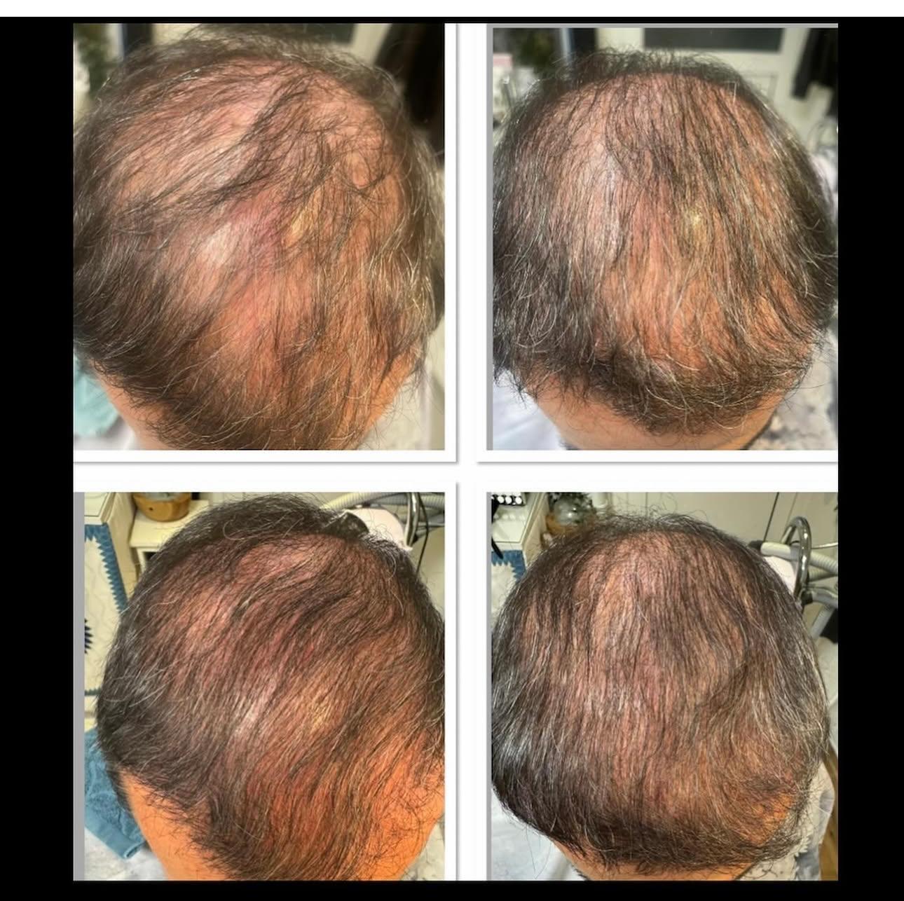 Vorher-Nachher Behandlung