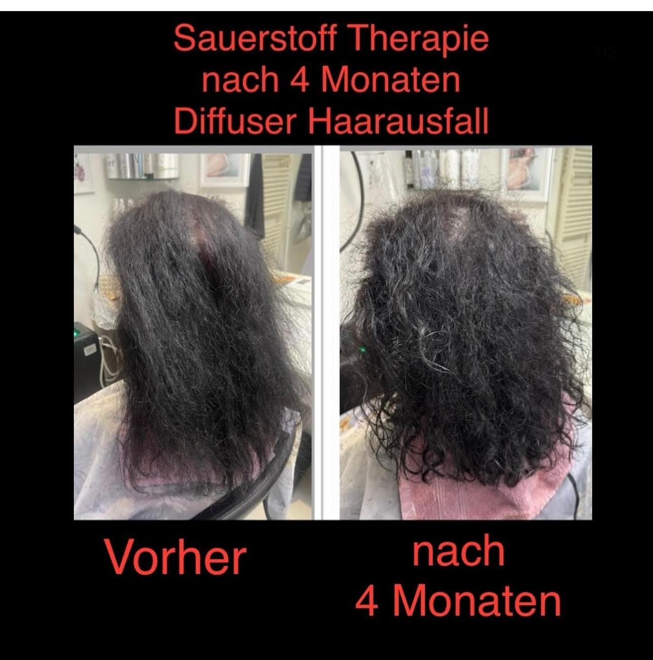 Vorher-Nachher Behandlung