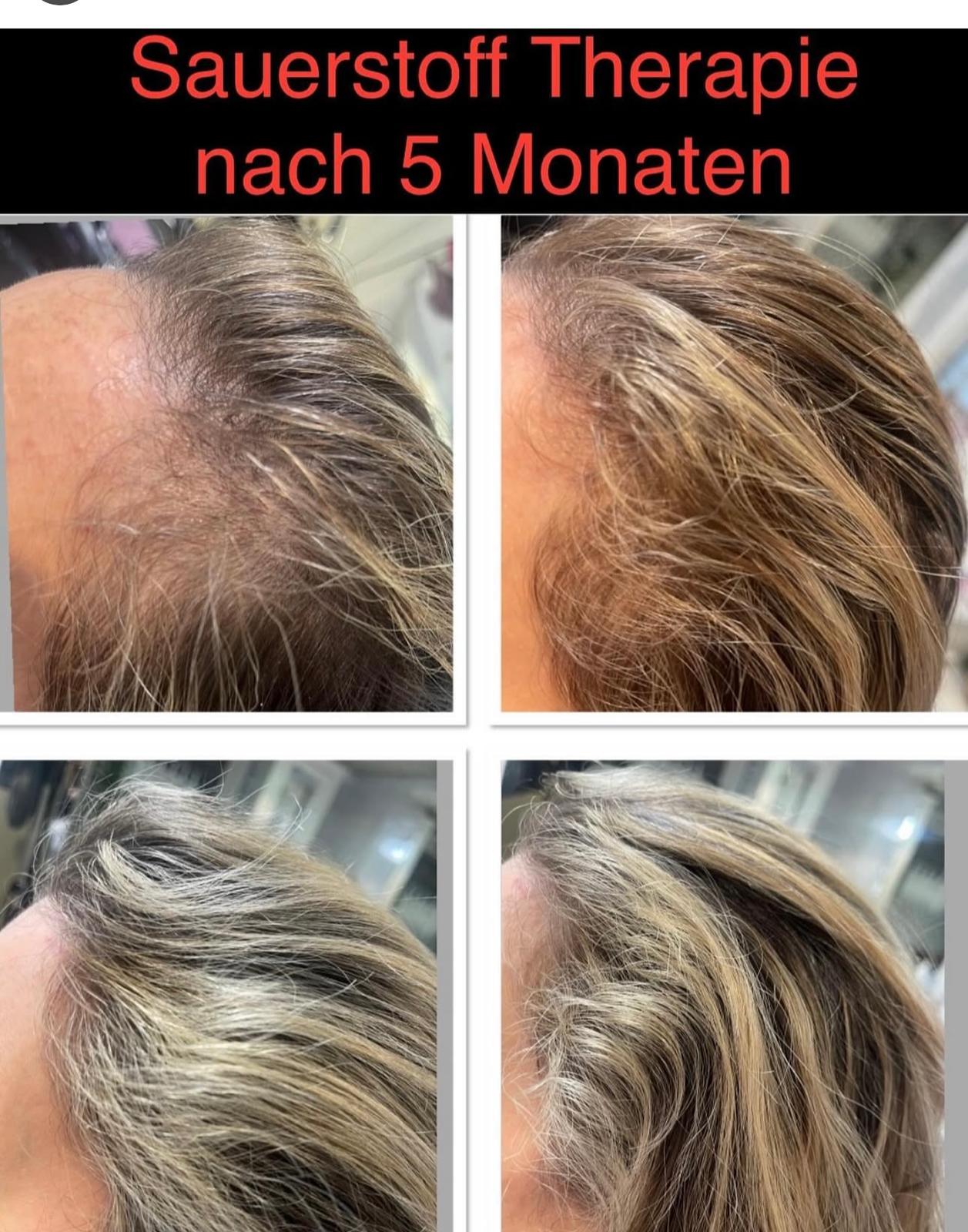 Vorher-Nachher Behandlung