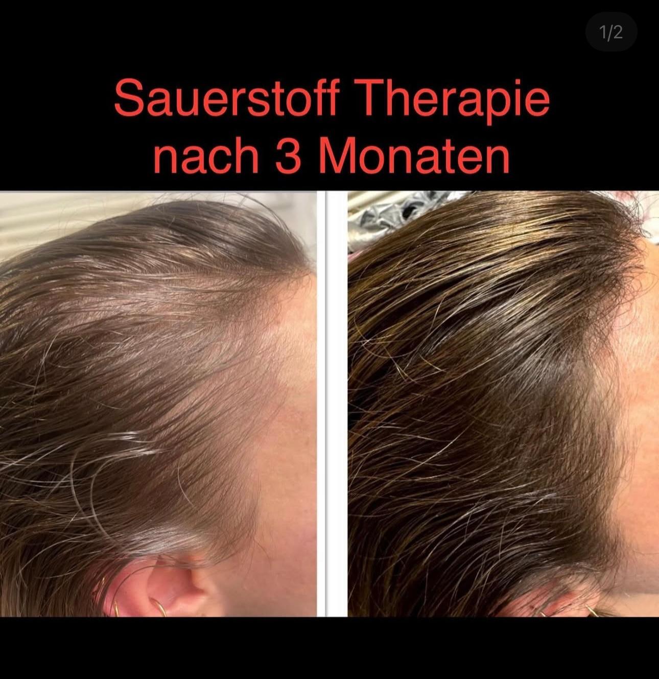 Vorher-Nachher Behandlung