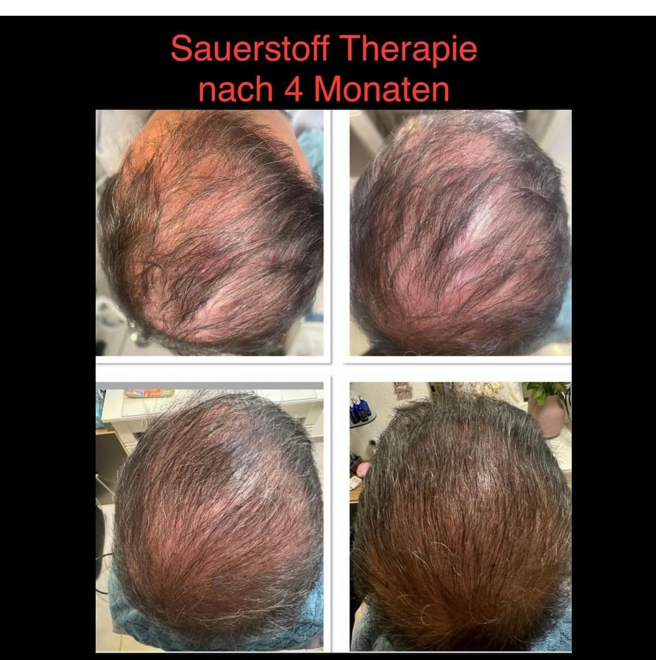 Vorher-Nachher Behandlung